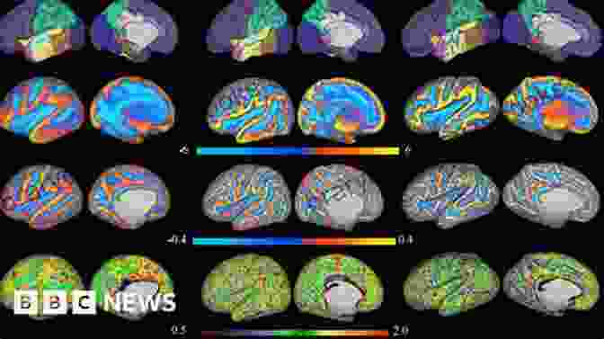 Brain Scan Revealing Heightened Neural Activity During Near Death Experiences Brink Of Death (Hidden Faces 1)