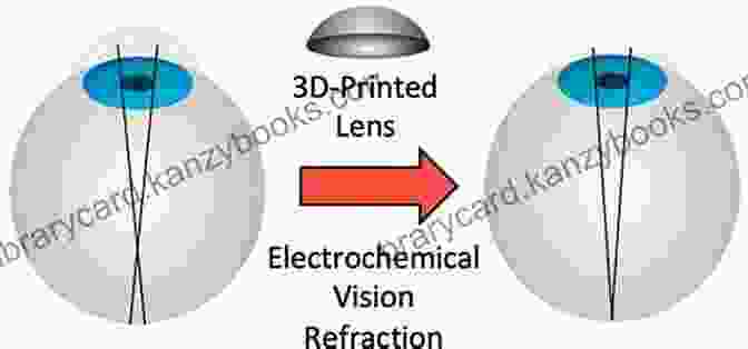 Corneal Reshaping For Vision Correction Improve Eyesight A Guide To Greater Vision Without Glasses: Eye Vision Improve Your Eyesight Naturally Perfect Sight Without Glasses Eye Diseases